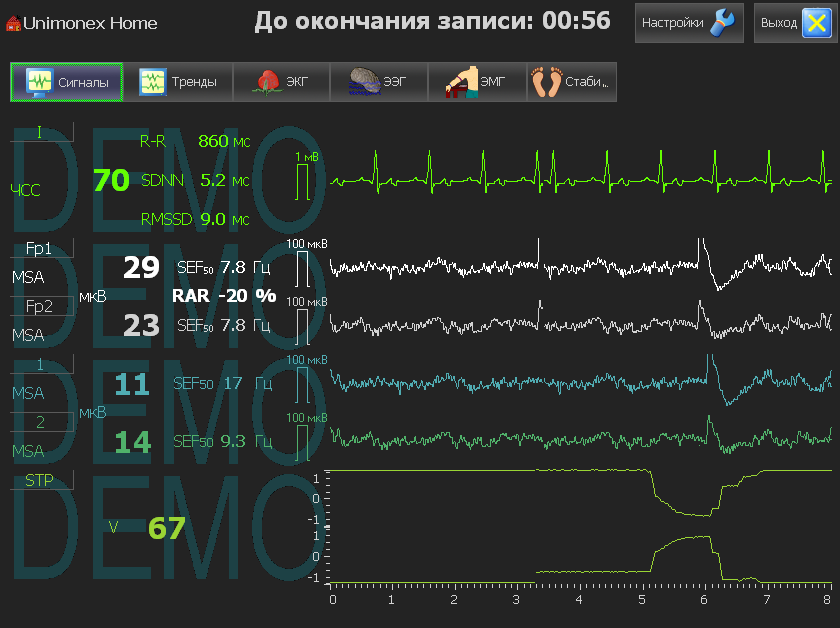 Кнопка "Сигналы" в правой части экрана включает режим отображения сигналов диагностики, а в левой - значения параметров мониторинга соответствующих методик.